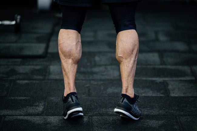 Plantar heel pain or Plantar Fasciopathy 1 - Stoney Stretton Physiotherapy Plantar heel pain 1 - Stoney Stretton Physiotherapy